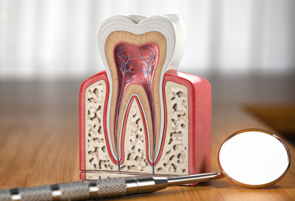 Root Canal Therapy Carmel