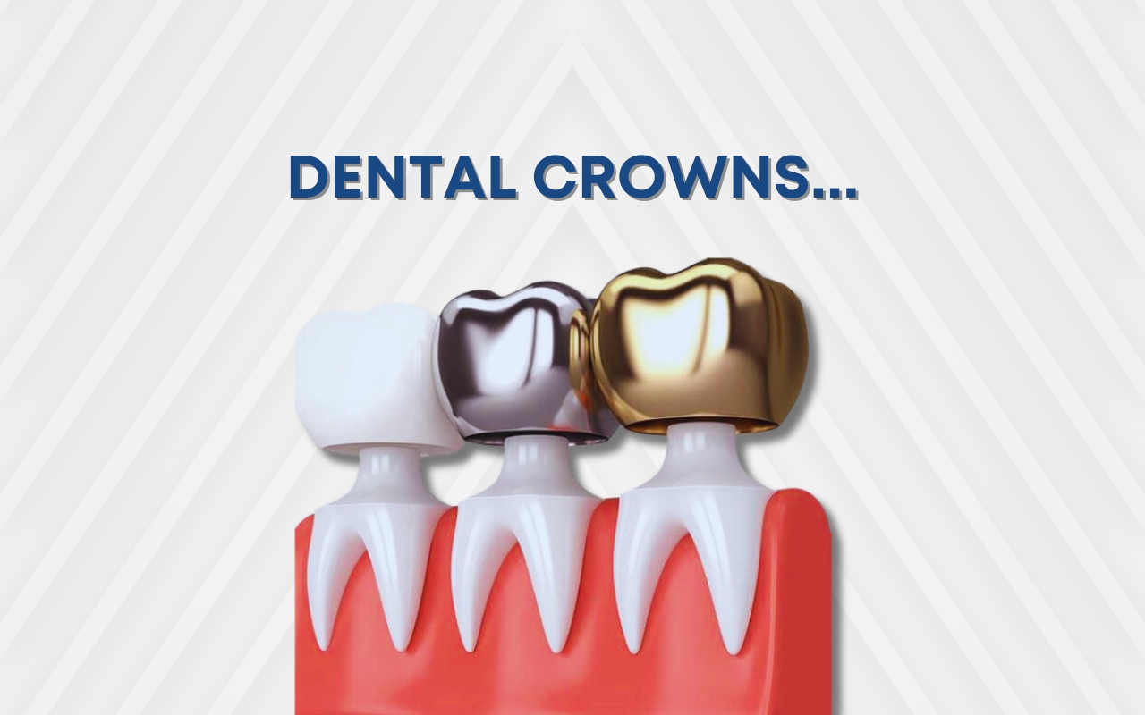 Different Types of Dental Crowns