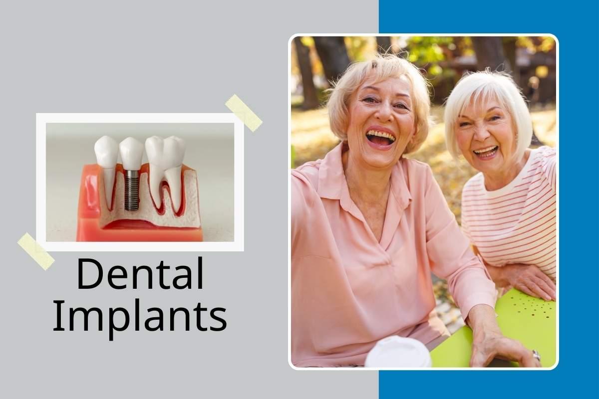What Can Dental Implants Support? Single Crowns to Full Arch Teeth