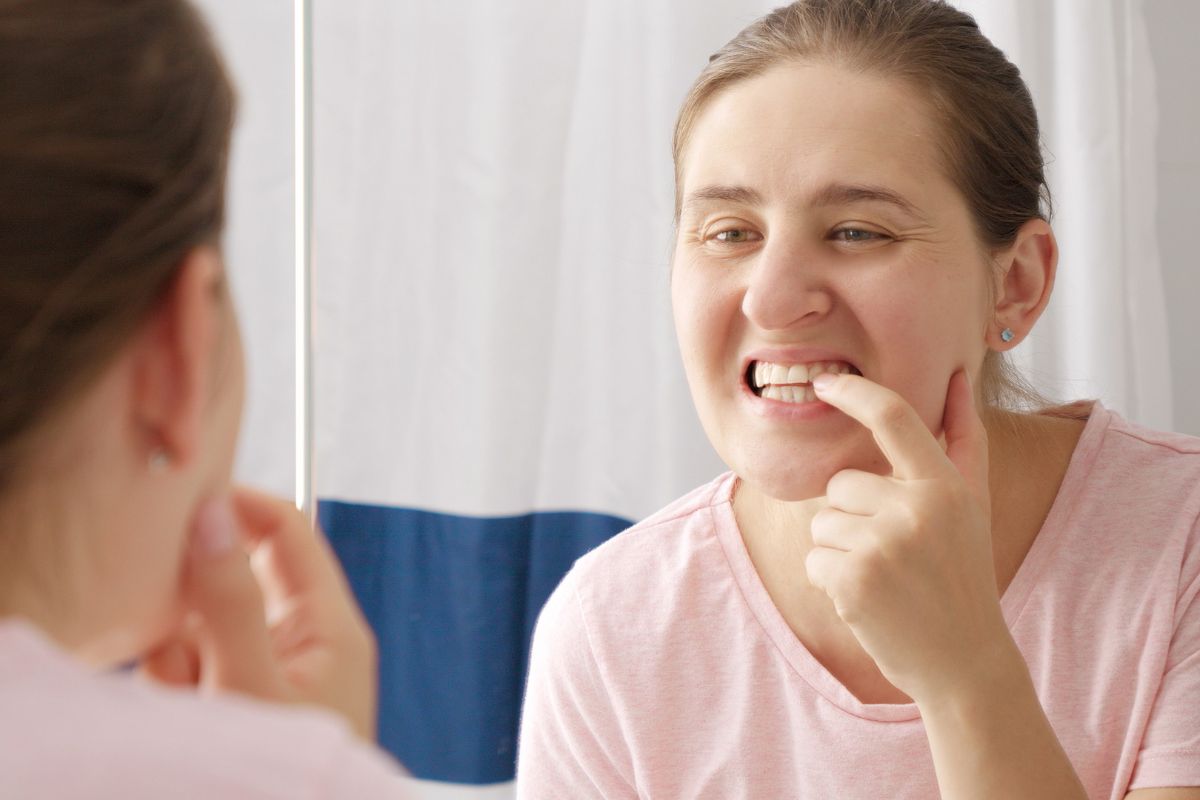 Why Teeth Yellow After Whitening