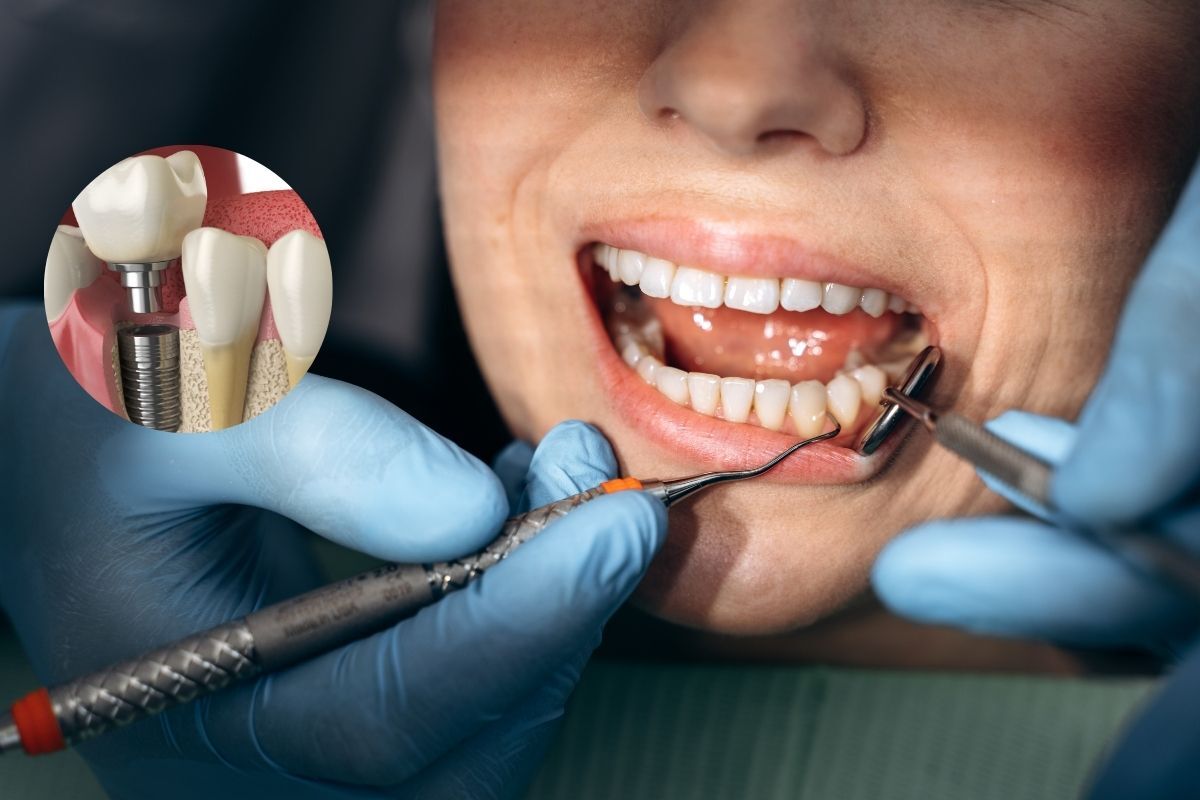 Dentist performing deep cleaning on patient's teeth with ultrasonic scaler during dental procedure.