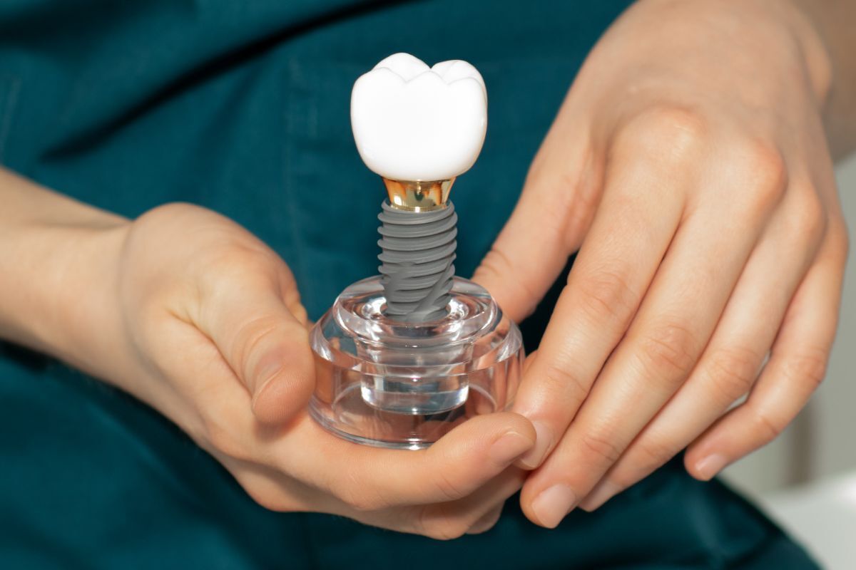 Dental implant model showing titanium screw and ceramic crown component in dentist's hands.